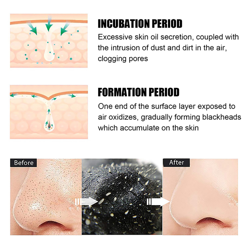 10/20/50/100 Peças de Adesivos - Charcoal Pore Strip avaliação e preço