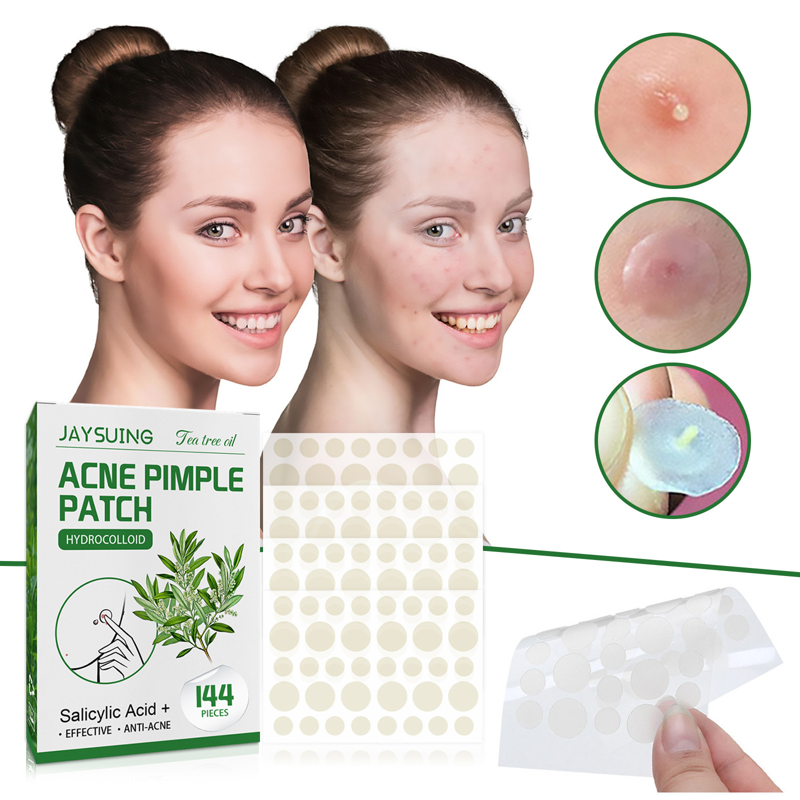 Patches hidrocolóides para acn - Hydrocolloid Acne Patch avaliação e preço