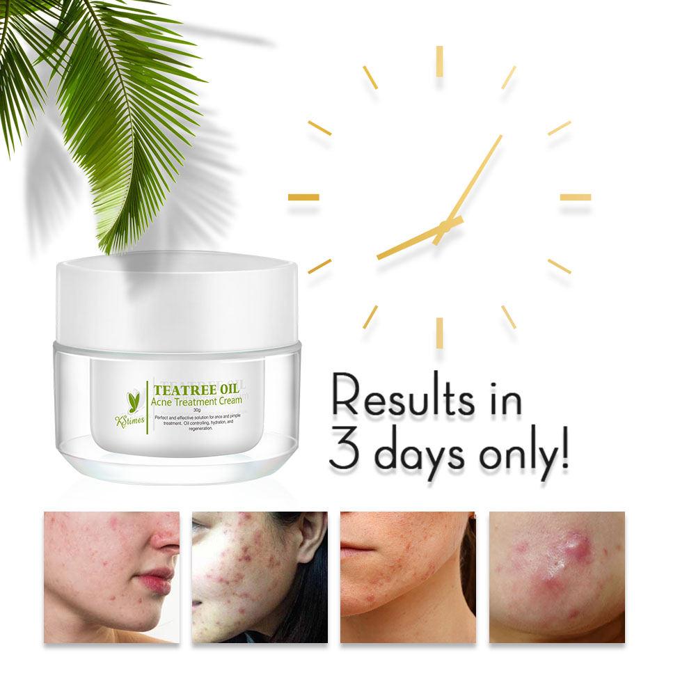 Kstims natural acne tratamento - Tea Tree Spot Treatment avaliação e preço